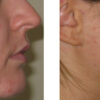 Skin Accumax - Image 3