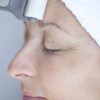 Cosmetic Roll-CIT® - Image 2