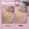 Skin Even IQ - Image 4