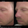 Jan Marini RosaLieve Redness Reducing Complex - Image 3