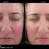 Jan Marini RosaLieve Redness Reducing Complex - Image 4