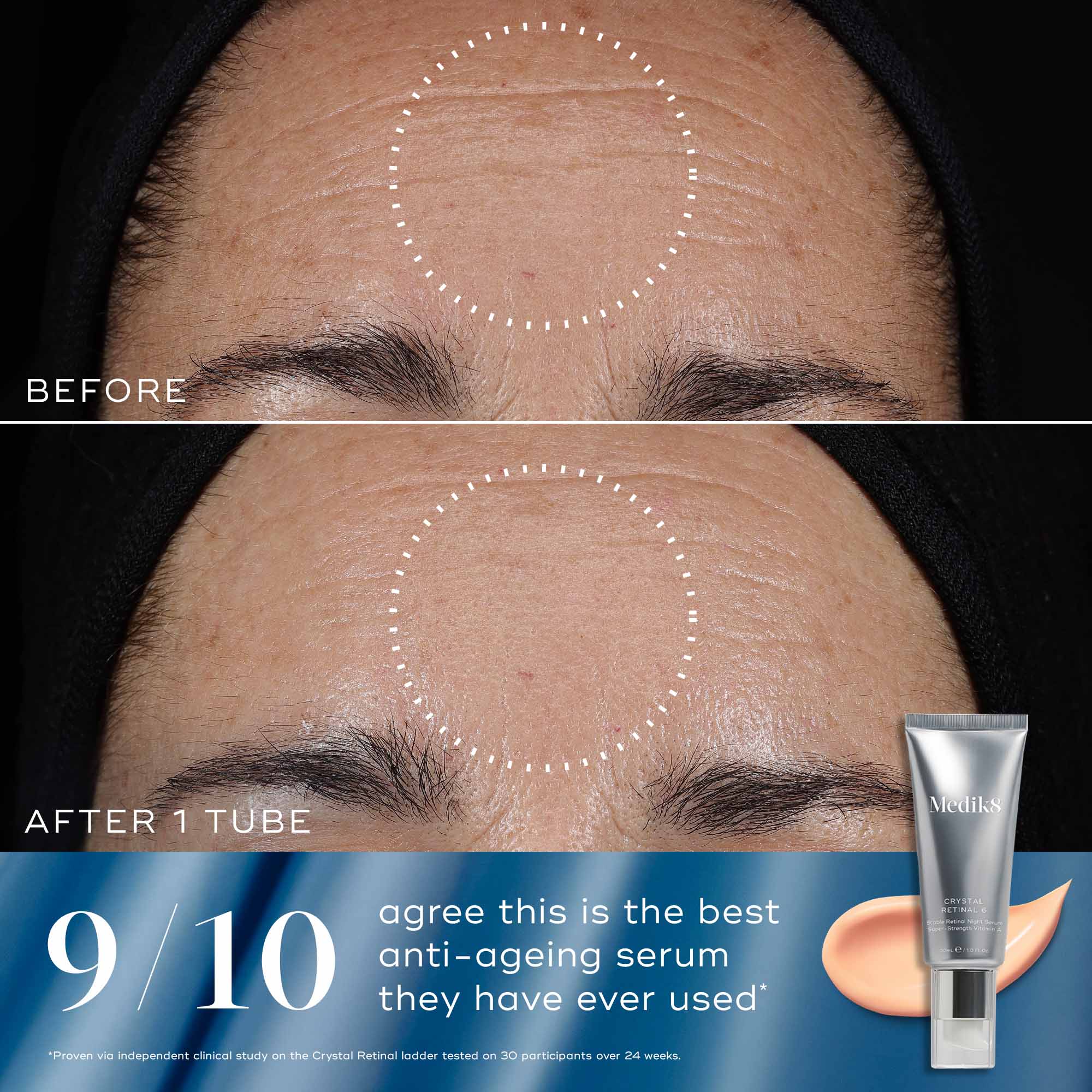 Medik8 Rejuvenation Reset - Image 4