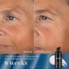 Medik8 Rejuvenation Reset - Image 5