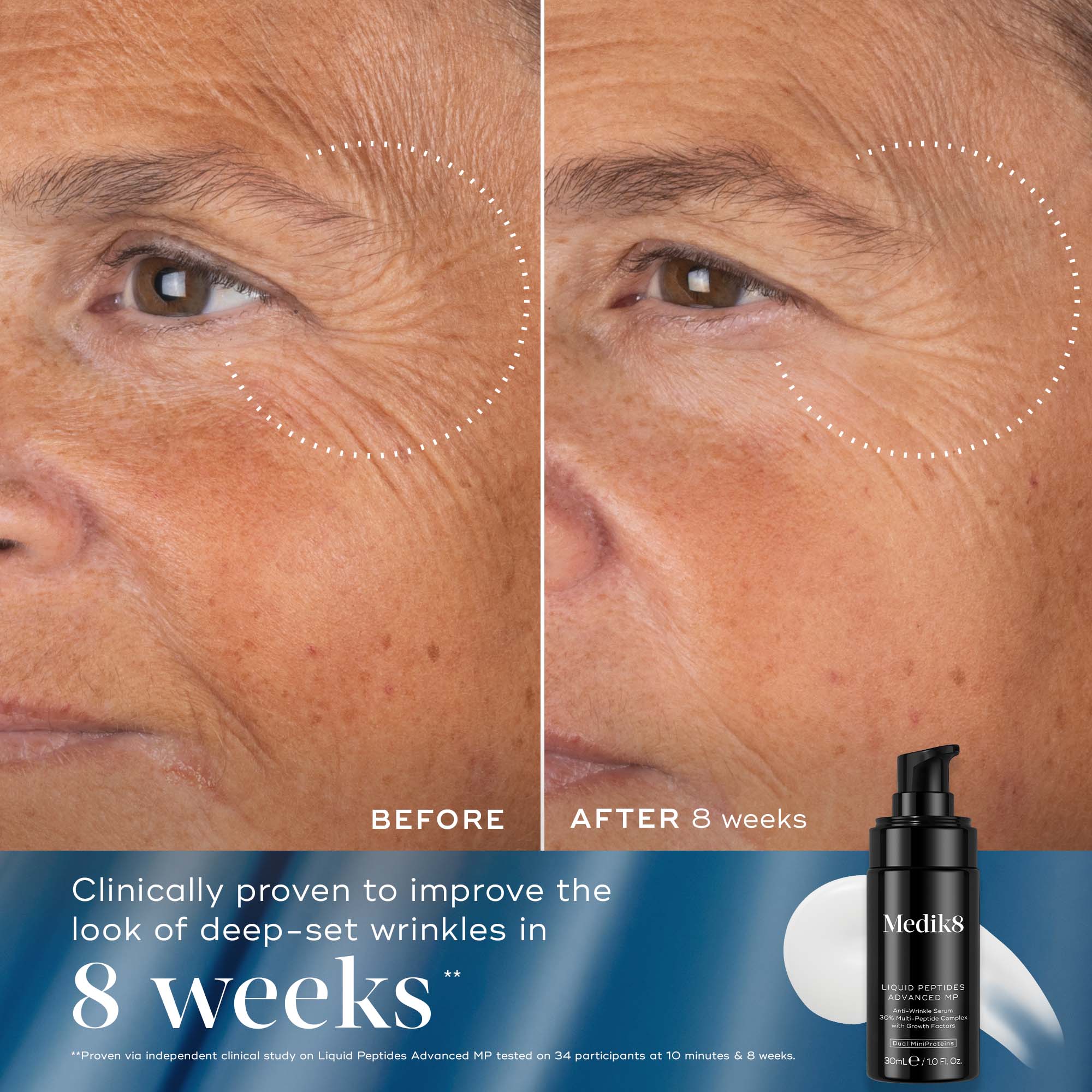 Medik8 Rejuvenation Reset - Image 5